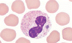 Rickettsia rickettsii